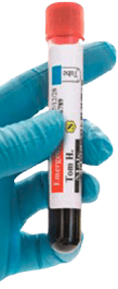 étiquette couleur sur tube de prélèvement de sang